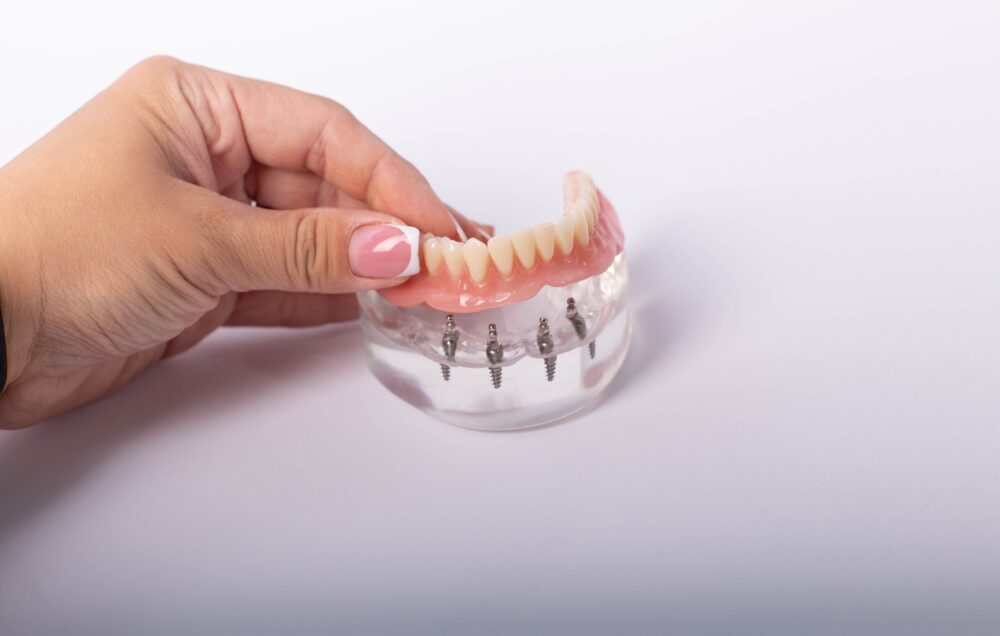 Overdentures rutherford